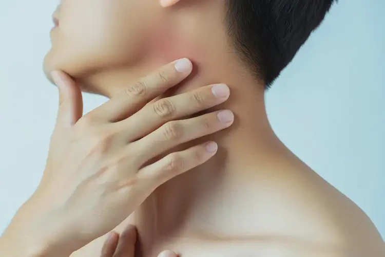 男性脖子上容易起濕疹可不可以根治(圖1)