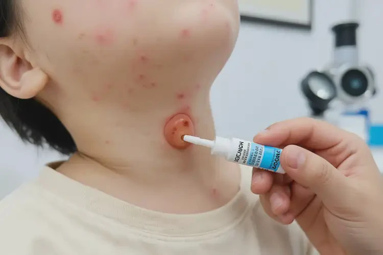 孩子脖子容易長濕疹不管它會自己自愈嗎(圖1)