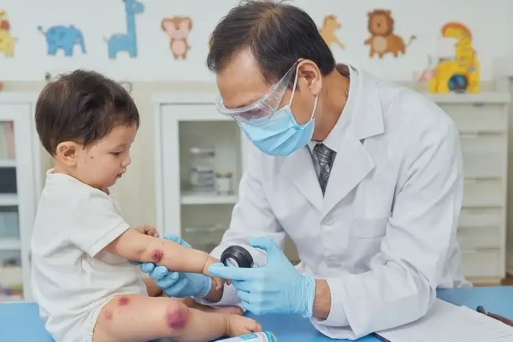 幼兒屁股偶爾長(zhǎng)濕疹可不可以根治(圖2)