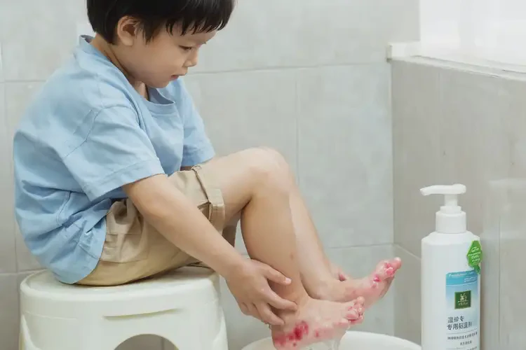 少儿脚上偶尔长湿疹能够彻底治愈吗(图2)