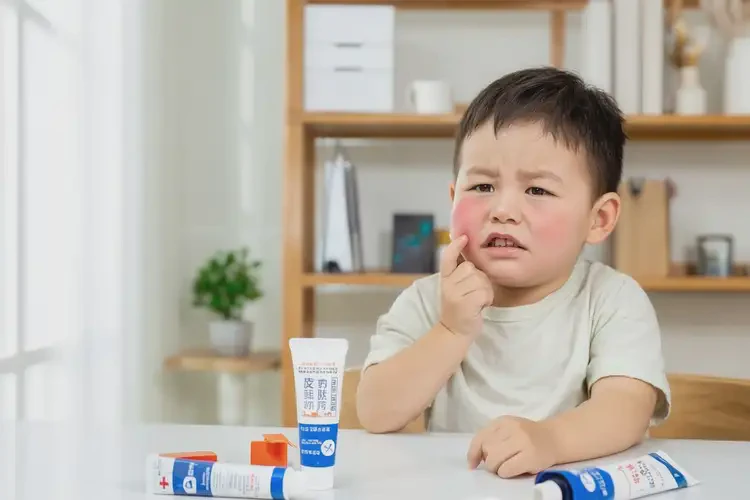 小孩面部出濕疹可不可以根治(圖1)