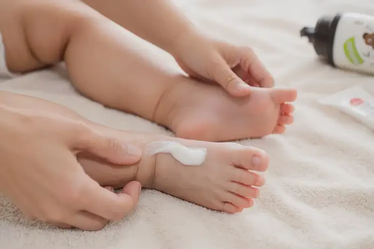 婴幼儿脚上出现湿疹可以彻底自愈吗(图3)