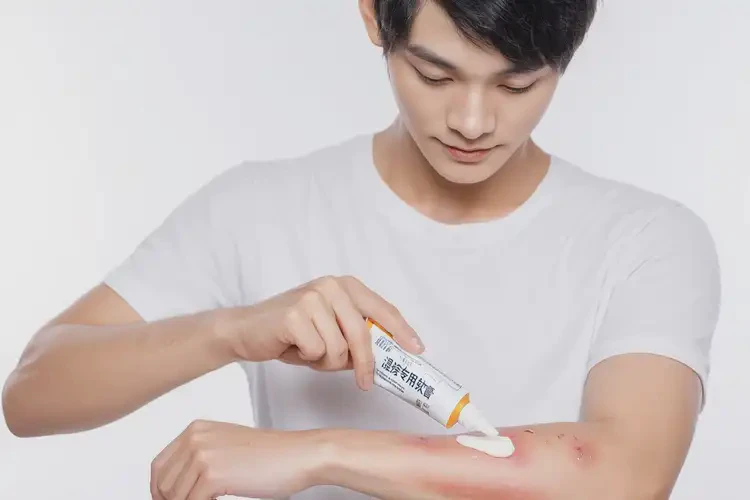 男生手臂上偶爾起濕疹可不可以根治(圖2)