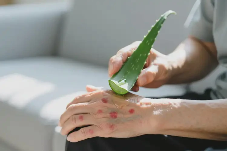 老人手上容易起濕疹可不可以根治(圖2)