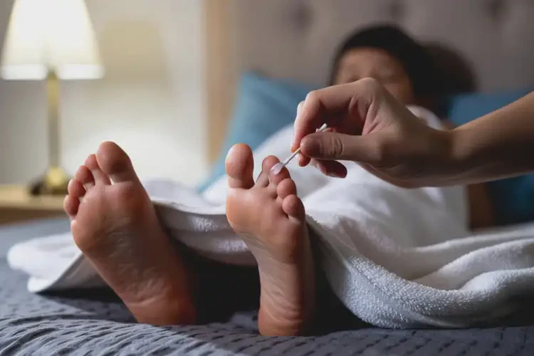 孩子脚上起湿疹可不可以根治(图2)