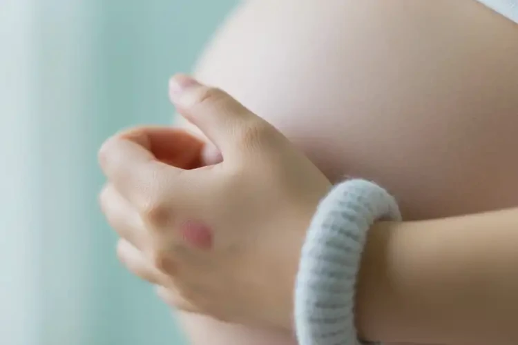 孕婦手上偶爾起濕疹能徹底自愈嗎(圖3)