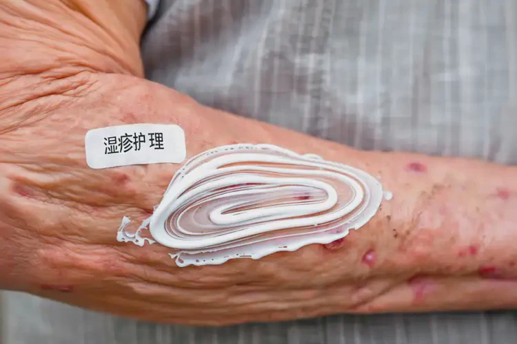 老人手臂上偶爾長濕疹能徹底自愈嗎(圖2)