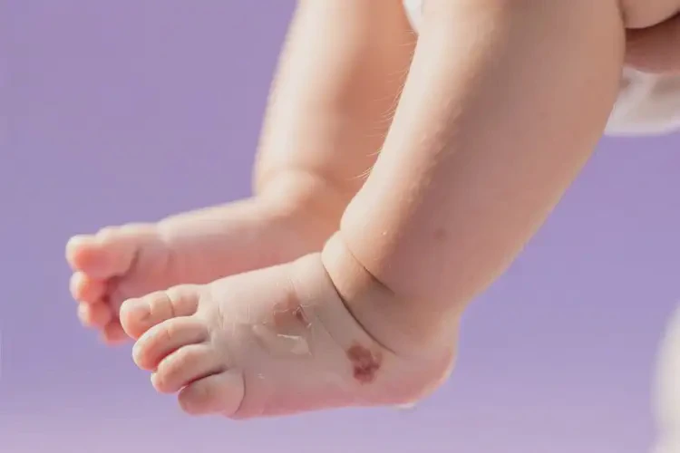 婴儿小腿经常起湿疹可不可以根治(图1)