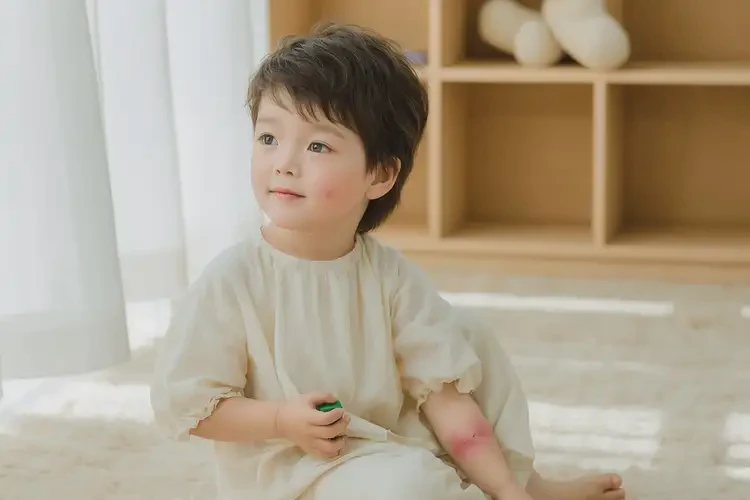 孩子全身出濕疹不管它會(huì)自己痊愈嗎(圖2)
