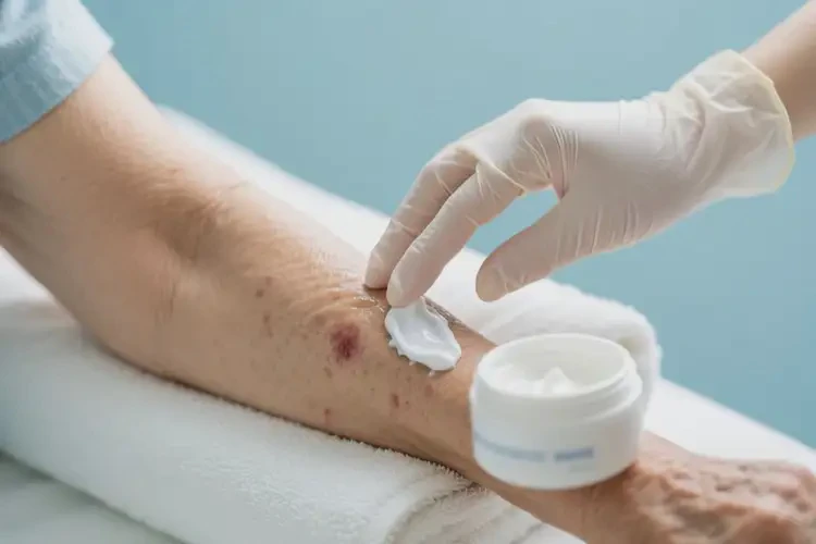 老年人手臂上長濕疹可不可以根治(圖3)