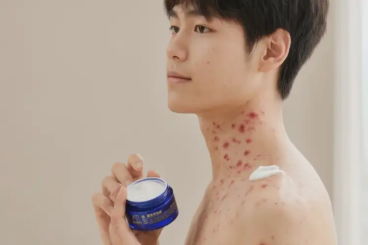 男生脖子上偶爾長(zhǎng)濕疹可不可以根治(圖3)