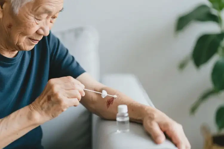 高齡老人手臂起濕疹可不可以根治(圖2)