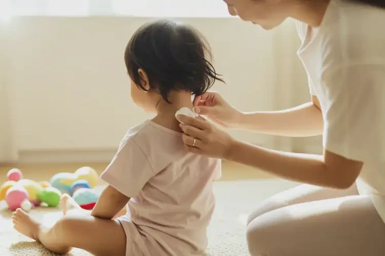 兒童脖子有濕疹可不可以根治(圖4)