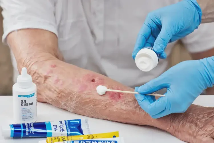 高齡老人手臂上起濕疹能不能根治(圖4)