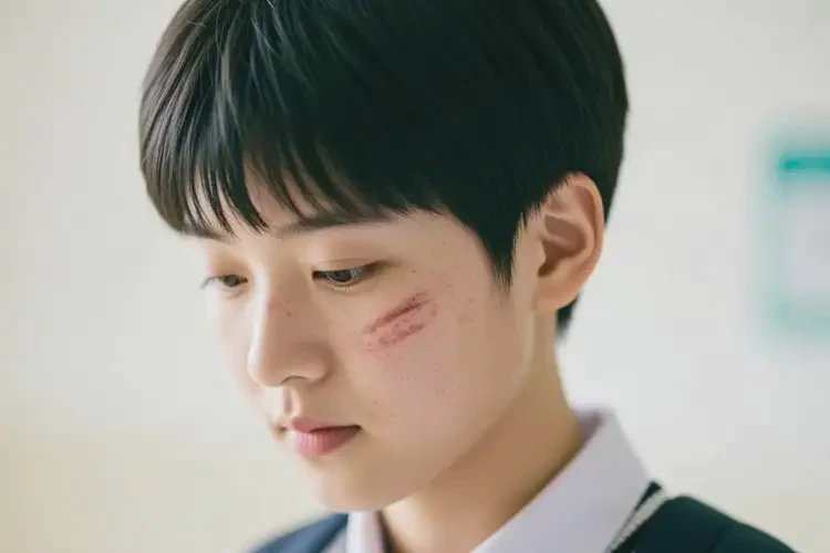 中學(xué)生臉上容易起濕疹可不可以根治(圖4)