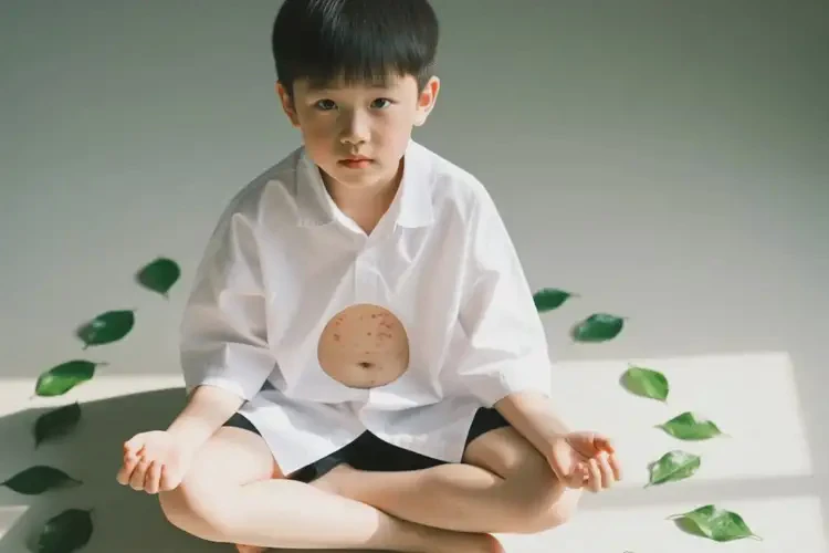中學生肚子偶爾起濕疹可不可以根治(圖2)
