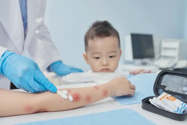 嬰幼兒手臂上偶爾長濕疹可以治好嗎(圖3)