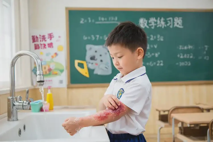 小學(xué)生手臂容易長濕疹可不可以根治(圖2)