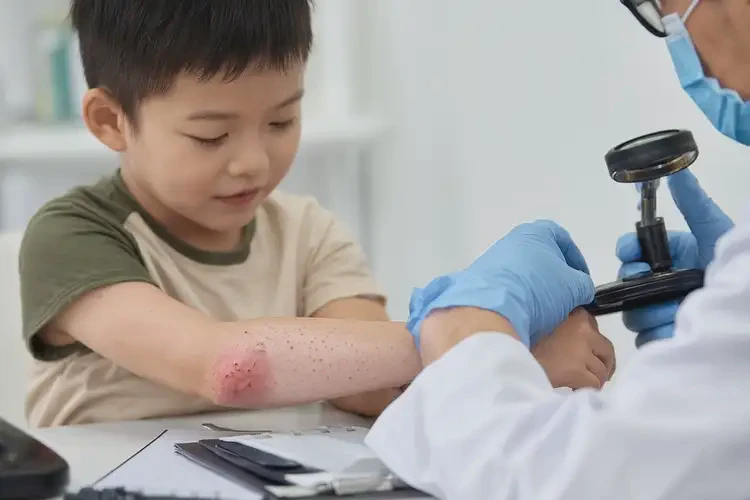 兒童手臂容易起濕疹可以治好嗎(圖4)