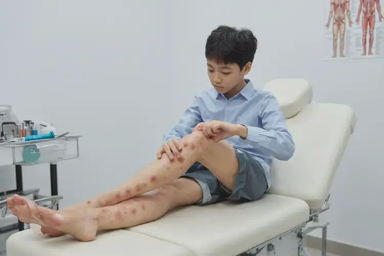 青少年小腿出濕疹能靠自己自愈嗎(圖4)