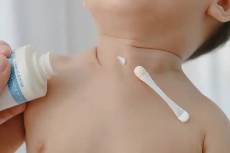 嬰兒脖子上偶爾長濕疹可以治好嗎(圖3)