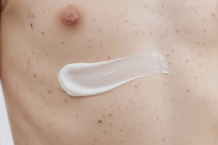 少儿肚子出现湿疹能靠自己自愈吗(图3)