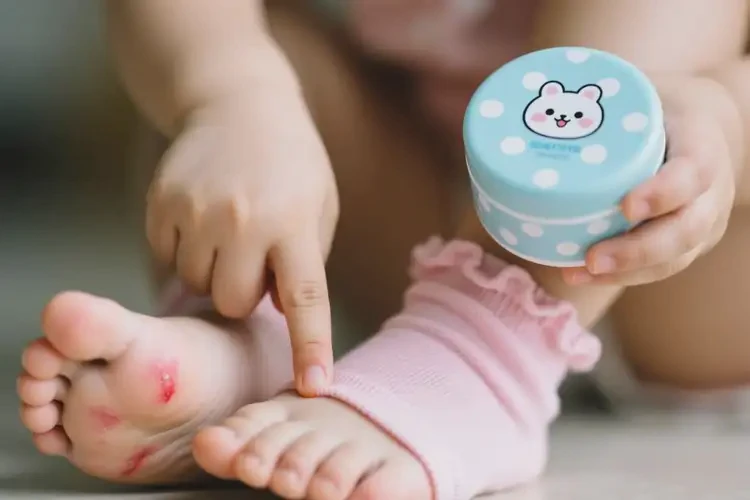 小孩四肢起湿疹可以治好吗(图3)