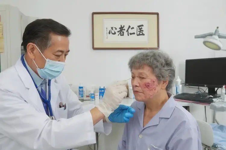 老年人脸上出湿疹可不可以根治(图3)