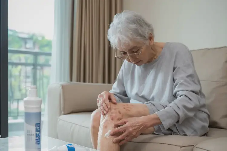 老年人大腿容易長濕疹可不可以根治(圖2)