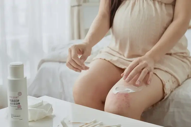 孕婦大腿偶爾長(zhǎng)濕疹可不可以根治(圖4)