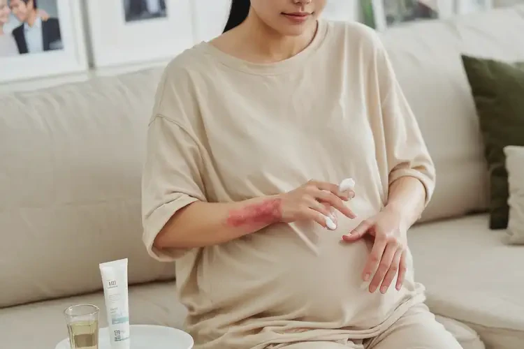 孕婦手上經(jīng)常起濕疹可以治好嗎(圖3)