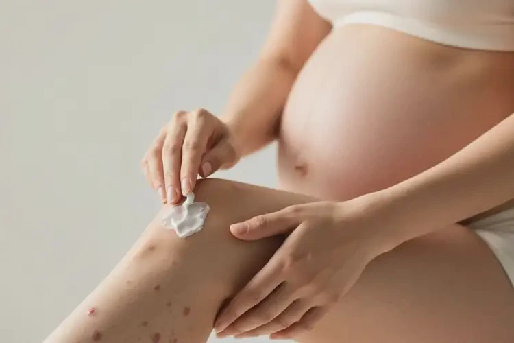 產(chǎn)婦小腿有濕疹可以治好嗎(圖4)