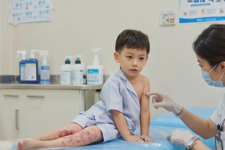 少兒肛周有濕疹可以治好嗎(圖4)