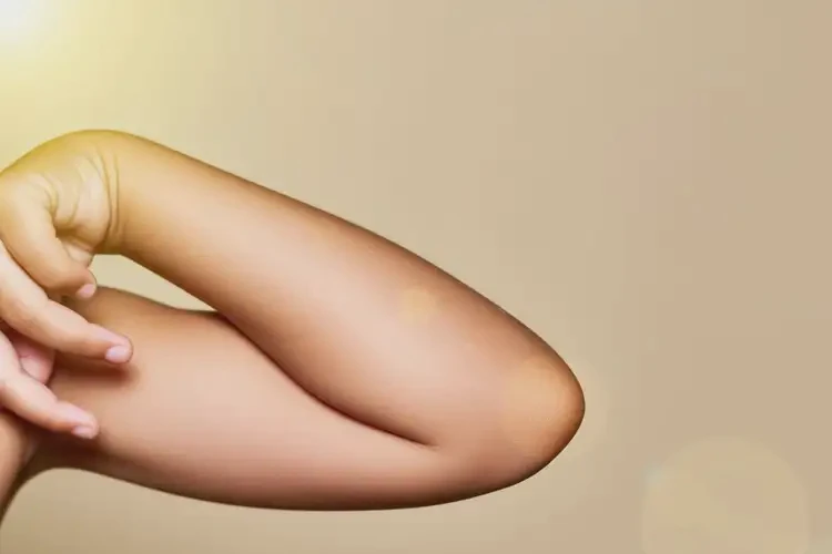 孩子手臂長(zhǎng)濕疹可以治好嗎(圖4)