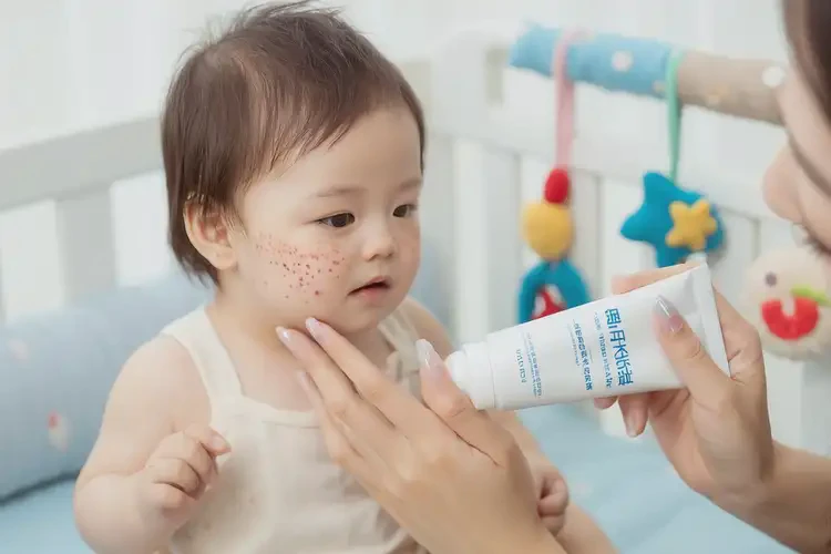 嬰幼兒身上起濕疹可以治好嗎(圖4)