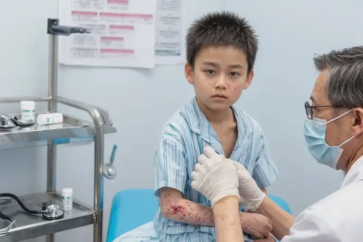 少兒全身經(jīng)常起濕疹不管它會自己痊愈嗎(圖1)