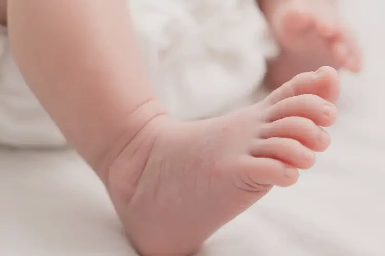 新生兒小腿有濕疹可不可以根治(圖4)