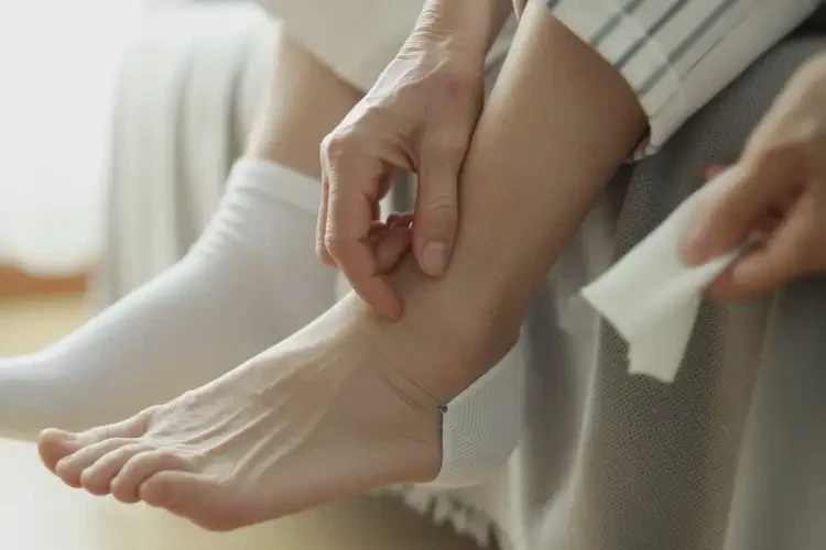 高齡老人腳上有濕疹可不可以根治(圖3)