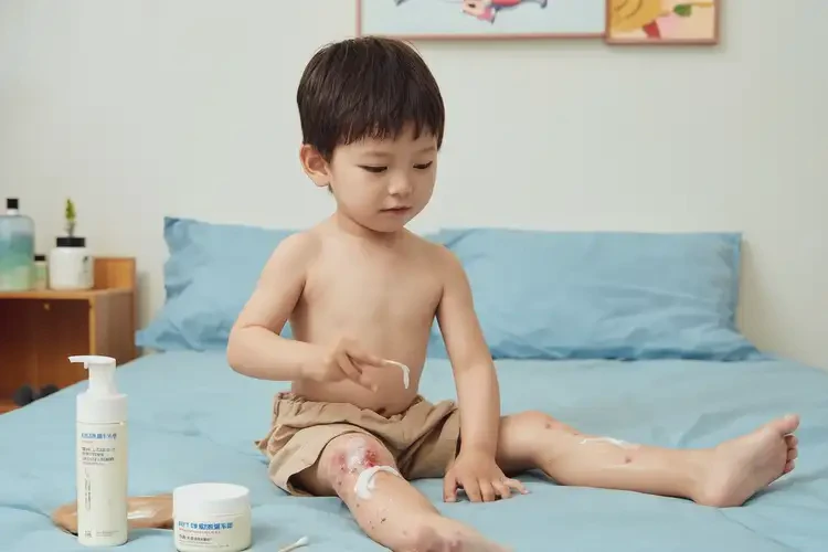 兒童大腿上偶爾長(zhǎng)濕疹可以治好嗎(圖2)