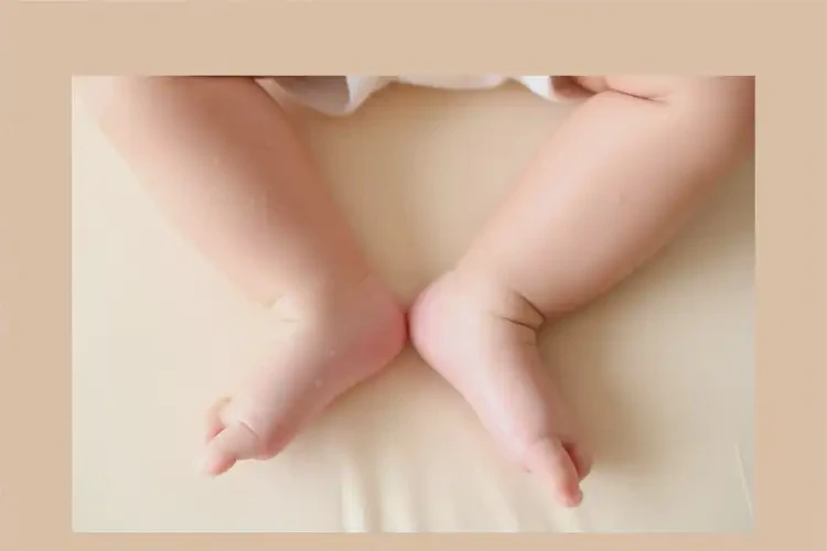 寶寶大腿上經(jīng)常長濕疹可以治好嗎(圖3)