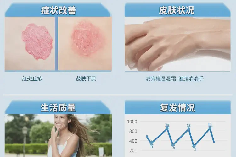 男人四肢有濕疹可不可以根治(圖1)