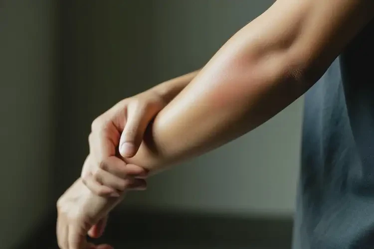 男性手臂上容易長濕疹可不可以根治(圖3)