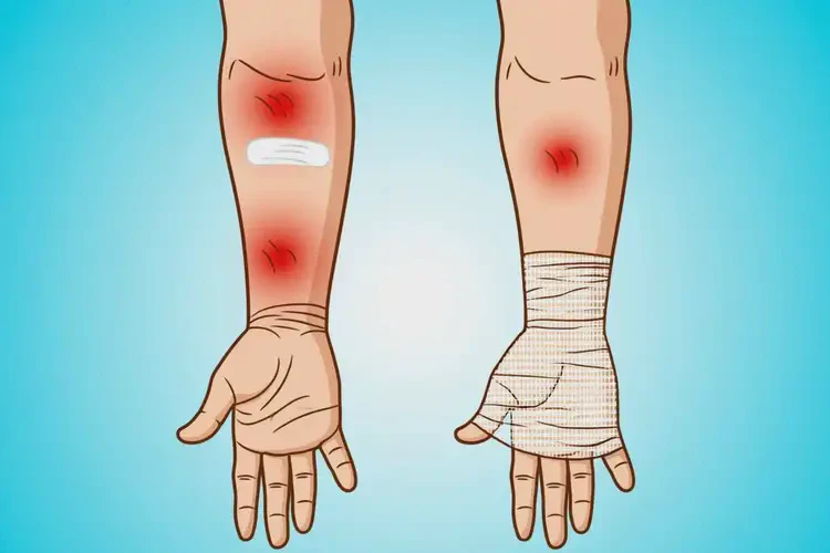 老年人手臂容易长湿疹可不可以根治(图3)