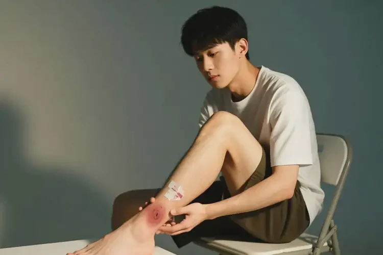 青年人腳上容易長(zhǎng)濕疹可不可以根治(圖3)