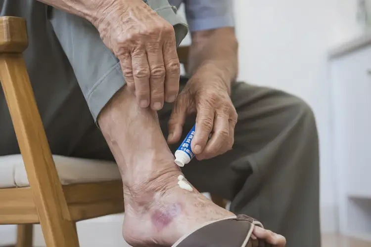 老年人小腿容易起濕疹可不可以根治(圖3)