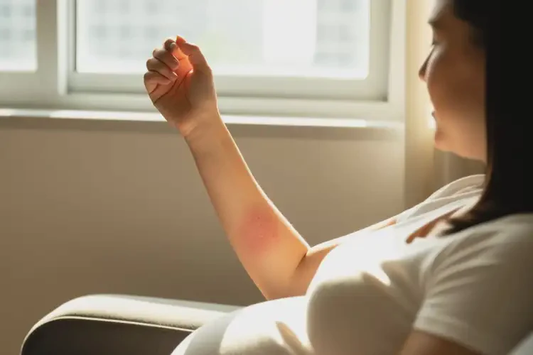 孕婦手臂上經(jīng)常長濕疹可以治好嗎(圖3)