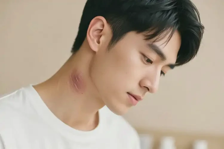 男性脖子上容易起濕疹可以治好嗎(圖4)