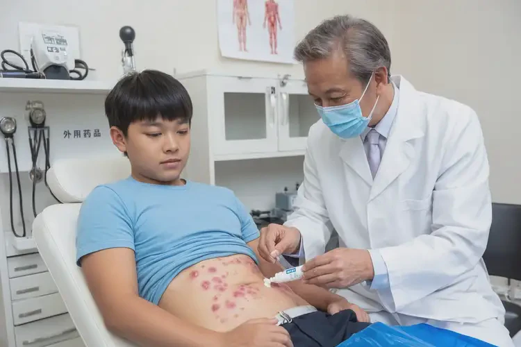 青少年肚子起濕疹可不可以根治(圖3)