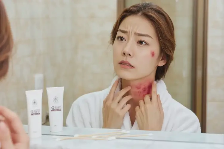 女性脖子偶爾長濕疹可以治好嗎(圖4)