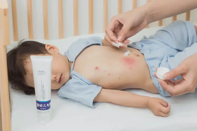 少兒肚子有濕疹可不可以根治(圖1)